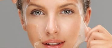 skin peels