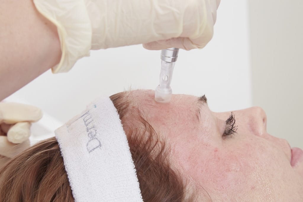 eds dermastamp microneedling treatment