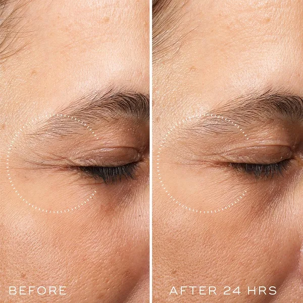 Medik8 Crystal Retinal Ceramide Eye before and after