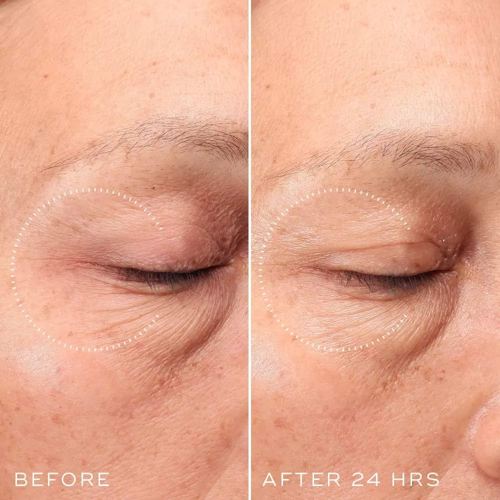 Medik8 Crystal Retinal Ceramide Eye before and after Manchester stockist