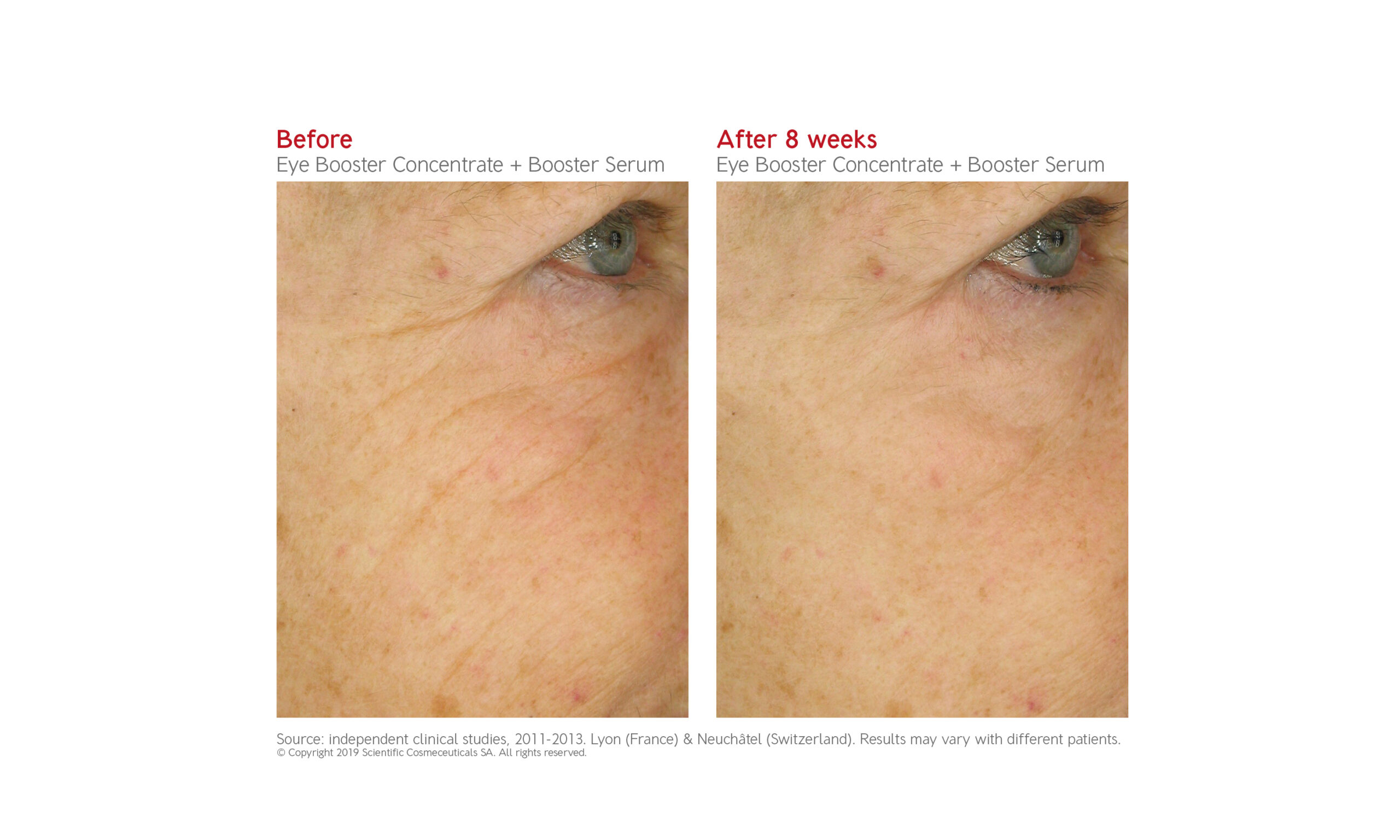 dr levy eye booster concentrate before after diane nivern manchester
