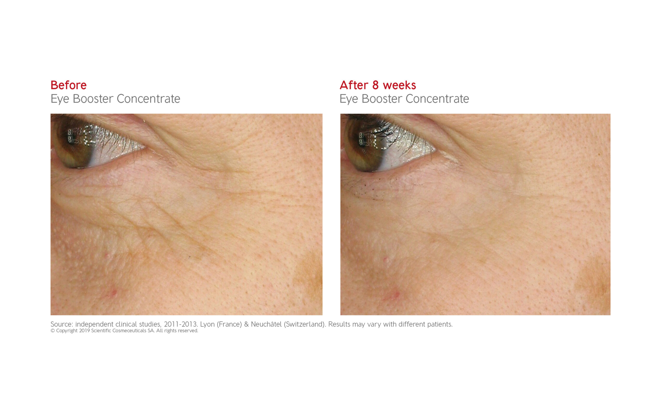 dr levy eye booster concentrate before after diane nivern whitefield