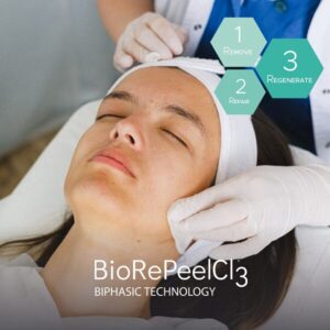 BioRePeel skin rejuvenation with no downtime manchester